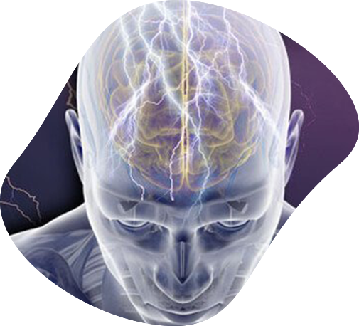 Epilepsy Disorders Image