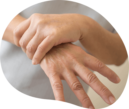 Movement Disorders Image
